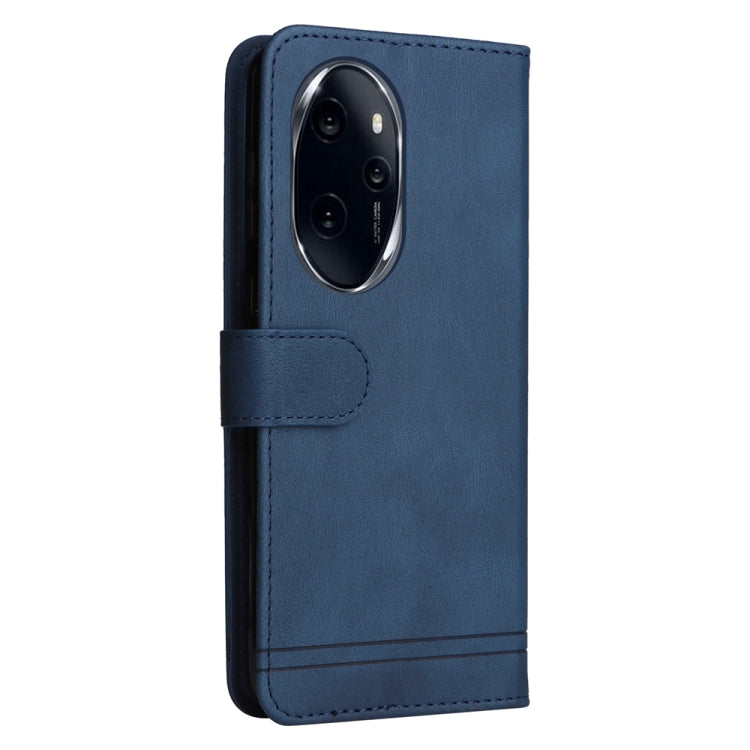 For Honor 100 Pro Skin Feel Life Tree Metal Button Leather Phone Case(Blue) - Honor Cases by PMC Jewellery | Online Shopping South Africa | PMC Jewellery | Buy Now Pay Later Mobicred