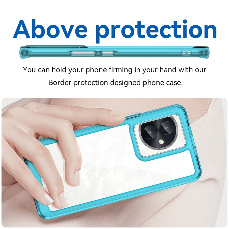 For Honor 100 Colorful Series Acrylic Hybrid TPU Phone Case(Transparent Blue) - Honor Cases by PMC Jewellery | Online Shopping South Africa | PMC Jewellery | Buy Now Pay Later Mobicred