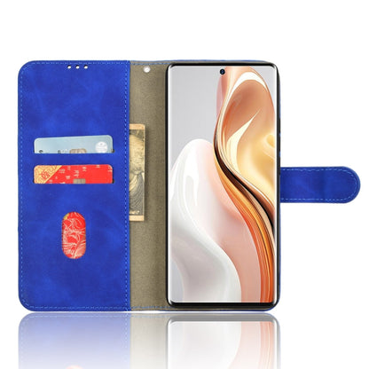 For Ulefone Note 17 Pro Skin Feel Magnetic Flip Leather Phone Case(Blue) - Ulefone Cases by PMC Jewellery | Online Shopping South Africa | PMC Jewellery | Buy Now Pay Later Mobicred