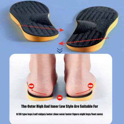 1pair O/X Leg Orthopedic Insoles Correction Shoe Inserts Arch Support Sports Shoe Pads, Size: 39-40(Black) - Shoes Care by PMC Jewellery | Online Shopping South Africa | PMC Jewellery