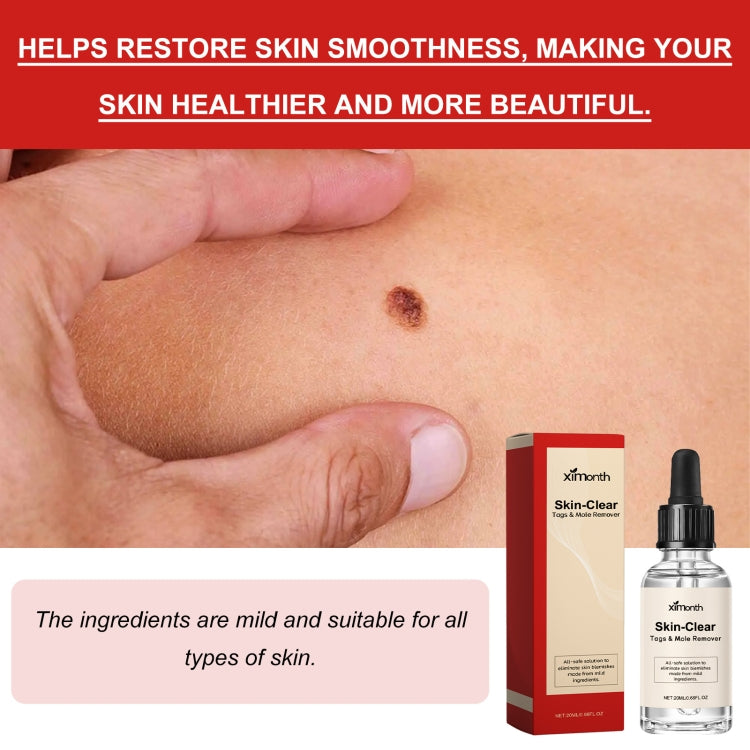 Ximonth 20ml/Bottle Anti Mole And Wart Liquid Dark Spot Tag Remover Skin Essence - free shipping - PMC TechLife - Order now!
