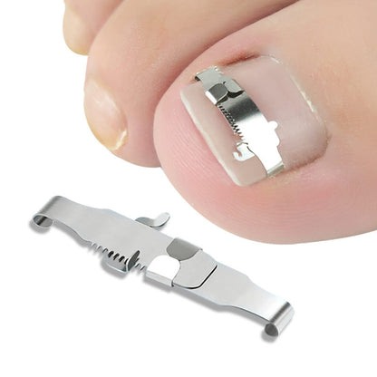 Orthopedic Buckle Toe Nail Groove Ingrown Nail Corrector, Style:No. 38, Specifications:Set - Corrector by PMC Jewellery | Online Shopping South Africa | PMC Jewellery