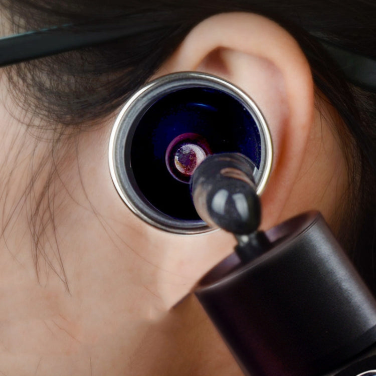 Ear Cleaning Hand Lamp USB Charging Otoscope(Rose Gold) - Ear Care Tools by PMC TechLife | Online Shopping South Africa | PMC TechLife